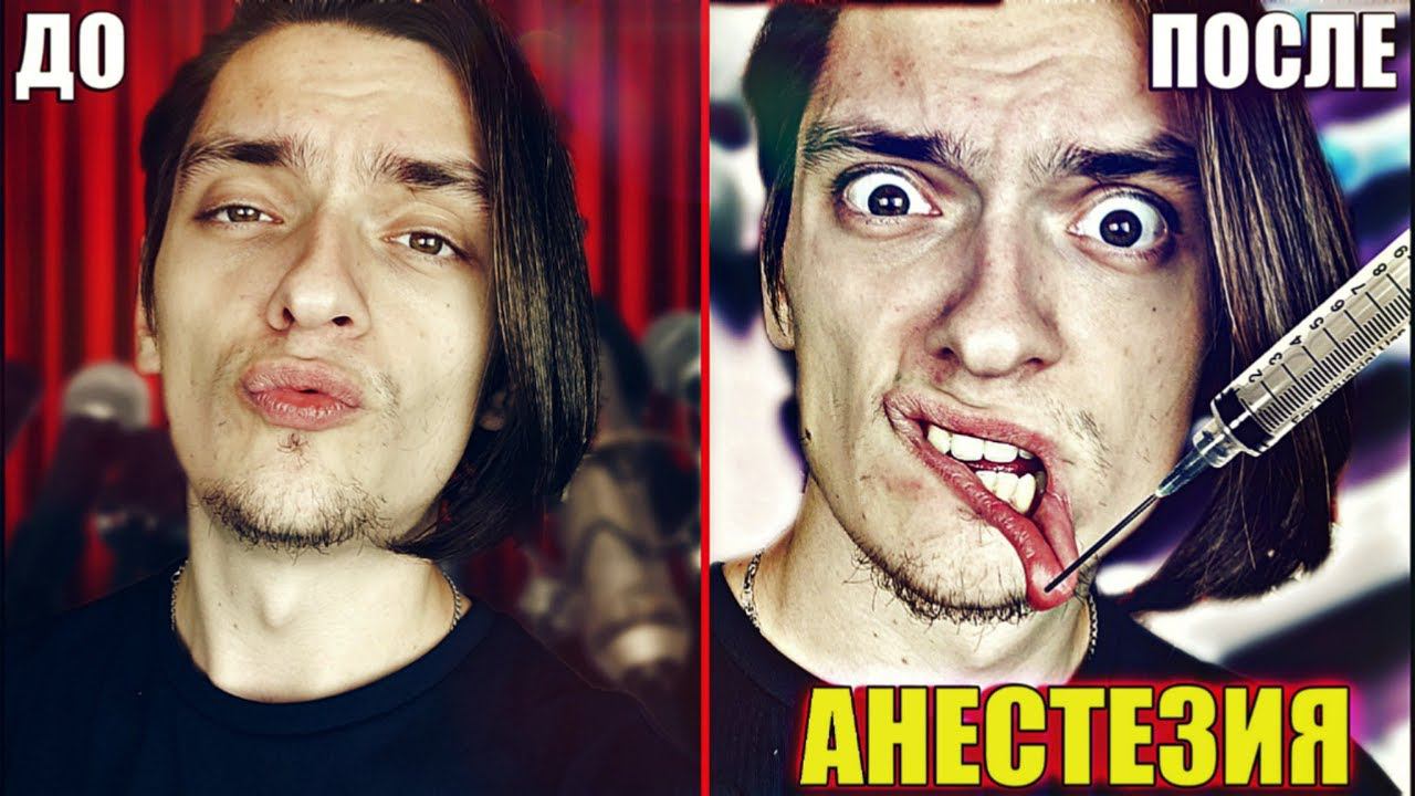 ЧТО БУДЕТ ЕСЛИ ДЕЛАТЬ БИТБОКС С АНЕСТЕЗИЕЙ? Эксперимент, проверил на себе! смотреть онлайн