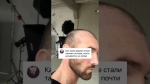 Пересадка волос APTI EZIEV