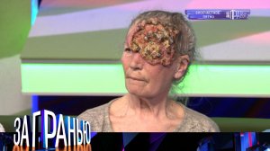 «За гранью»: «Злосчастное пятно» | Остросоциальное шоу с Сергеем Соседовым