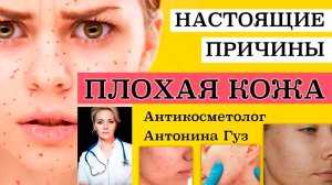 Антикосметолог _ ПЛОХАЯ КОЖА - ПРИЧИНЫ