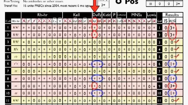 Antibody ID: Basic Cases (Part 2) смотреть онлайн