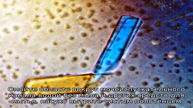 Анализ мочи на белок Бенс-Джонса смотреть онлайн