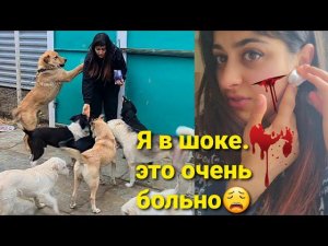 Меня ПОКУСАЛИ собаки