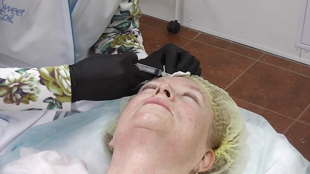 Практическое занятие по мезотерапии в Учебном центре КРЦ смотреть онлайн