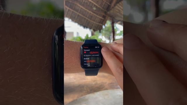 Apple Watch спасут жизнь!