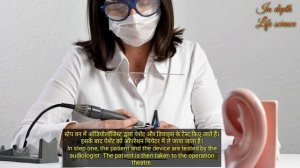 कॉक्लियर इम्प्लांट | cochlear implant in hindi | cochlear implant how it works | Hearing loss