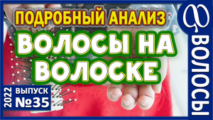 ВОЛОСЫ. Облысение. Поражение и дегенерация волосяных луковиц. Что проверить? Седина. Алопеция.