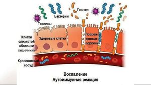 Л глютамин - лучший заживлятор для желудочно-кишечного тракта