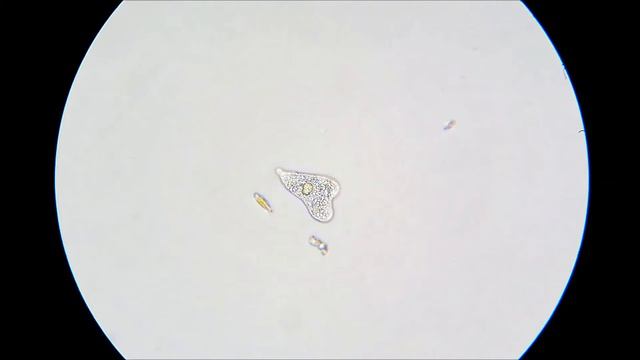 Амёба Trichamoeba sinuosa смотреть онлайн