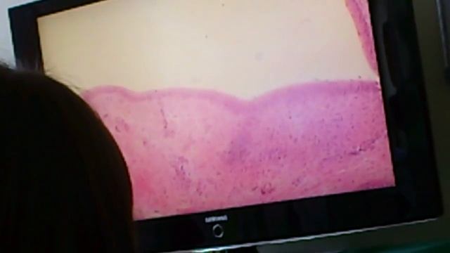 Гистология Мочевой пузырь смотреть онлайн