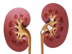 Лучшие народные средства для выведения камней из почек