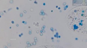 Инфузории рода Paramecium накормленные окрашенными дрожжами