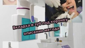 Вкладка в зуб под коронку - описание метода