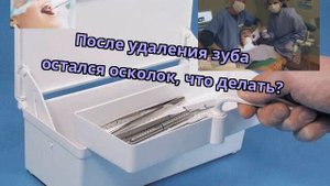 После удаления зуба остался осколок, что делать?