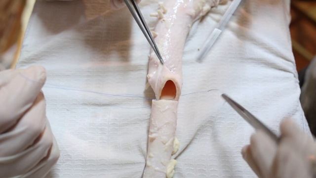 СОСУДИСТЫЙ АНАСТОМОЗ КОНЕЦ В КОНЕЦ (ПАРАШЮТНАЯ ТЕХНИКА) / VASCULAR ANASTOMOSIS (PARACHUTE TECHNIQUE