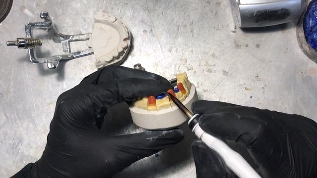 Зубной мост (Каркас под металлопластмасcу) смотреть онлайн