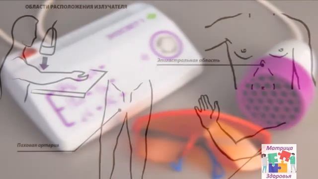 Как действует аппарат Экосвет 1