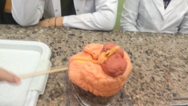 Анатомия | Головой мозг