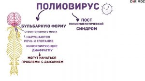 Полиомиелит - причины, симптомы, диагностика, лечение, вакцины
