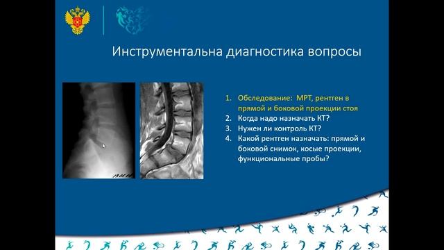 Спондилолиз и спондилолистез у спортсменов   тактика лечения