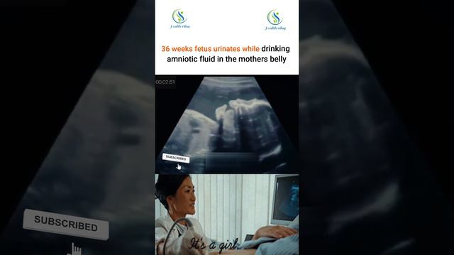 36 weeks fetus urinates while drinking amniotic fluid in the mother belly #pregnant #fetus #urinate