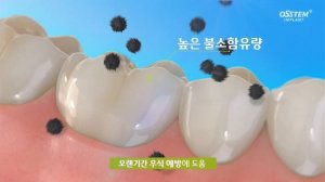 '탕후루 열풍'에 우리 아이 치아 걱정은?