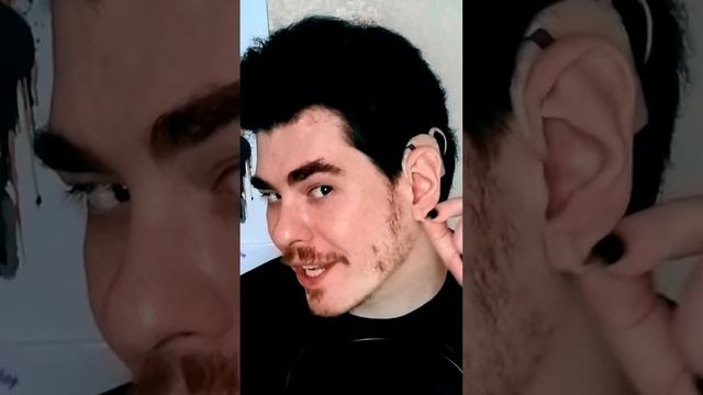 Чем отличается слуховой аппарат от кохлеара #shorts #sidny #жизнь #рассказ #инвалидность #глухие смотреть онлайн