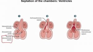 USMLE RX - 2.Кардиология - 2.Эмбриология - 3.Морфогенез сердца