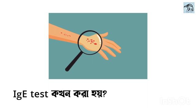 IgE test procedure | IgE টেস্ট কেন করা হয় | এলার্জি পরীক্ষার খরচ কতো смотреть онлайн
