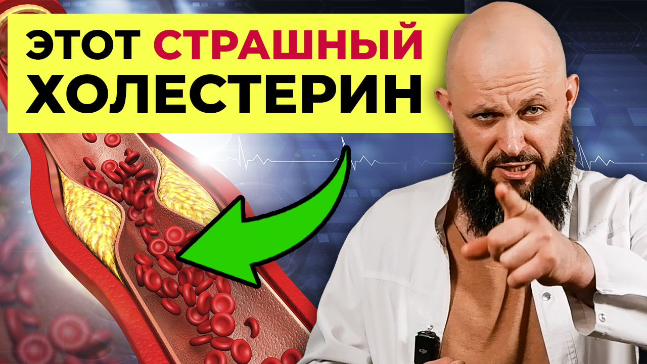 Как снизить холестерин БЕЗ ЛЕКАРСТВ! / Это спасет от инфаркта и инсульта!