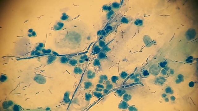 Пластинки грибов под микроскопом. Базидии грибов под микроскопом. Клетки грибов под микроскопом. Группа грибков кандидоз.