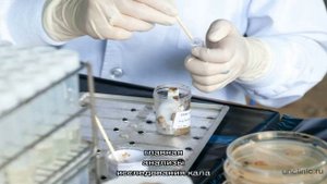 Анализ кала на простейшие