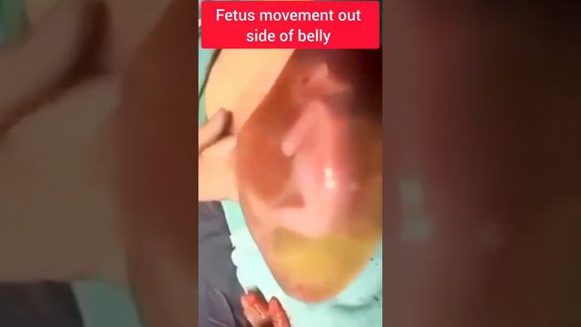 fetus movement in amniotic fluid 😮 #cutebaby #baby #respectmother #babylove