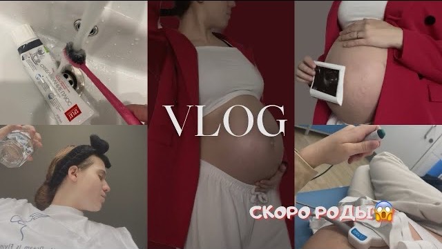 СКОРО РОДЫ | 40 неделя БЕРЕМЕННОСТИ | КТГ