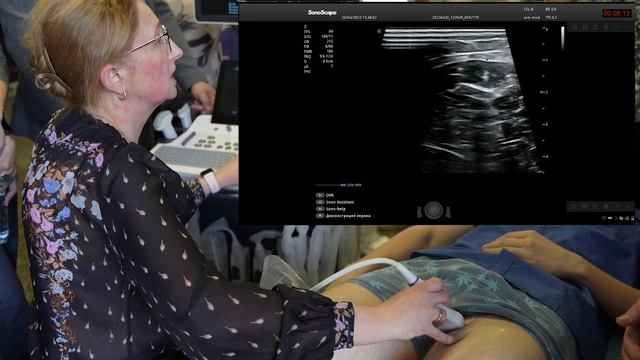Мастер-класс: Ультразвуковое исследование вен нижних конечностей. Кривошеева Н.В.