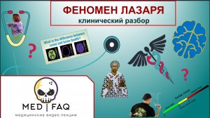 Клинический разбор - Сндром Лазаря