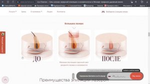 Важные контентные блоки - SEO продвижение запросов лазерная эпиляция