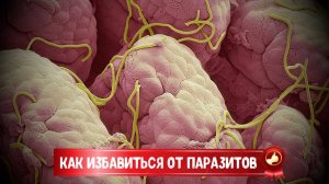 КАК ИЗБАВИТЬСЯ ОТ ПАРАЗИТОВ