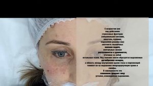 Заполнение носослезной борозды