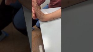 ПЕРЕЛОМ ЛУЧЕВОЙ КОСТИ СО СМЕЩЕНИЕМ | Результат восстановления | Доктор Юршин