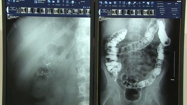 Visualizing Tomorrow: EIZO Medical Monitor Solutions at RSNA 2015 смотреть онлайн