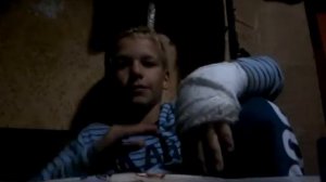 Сломал руку гипс