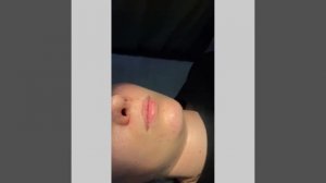 Биополимер в губы