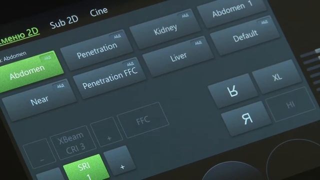 В десятой больнице появился универсальный аппарат УЗИ с удобным интерфейсом смотреть онлайн