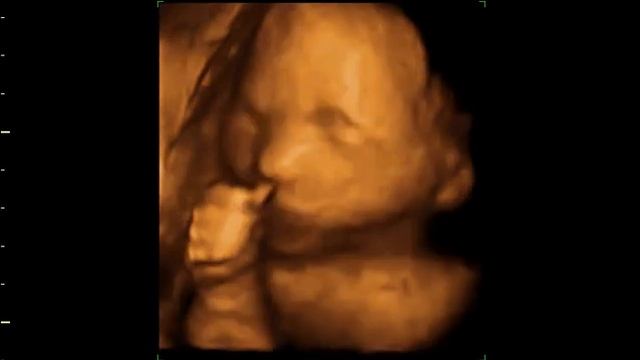 23 Week Old Baby - 3D 4D Ultrasound New Jersey смотреть онлайн