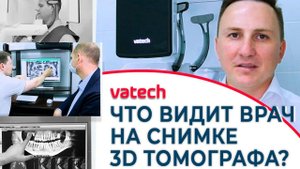 Что видит врач на снимке 3D томографа