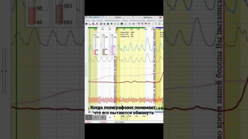 Юмор, просто юмор! Только опытный полиграфолог способен отличить ложь от случайной реакции!