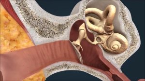 Воспаление среднего уха