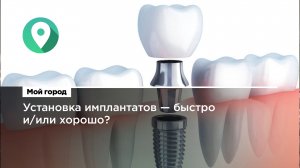 Установка имплантатов – быстро и/или хорошо?