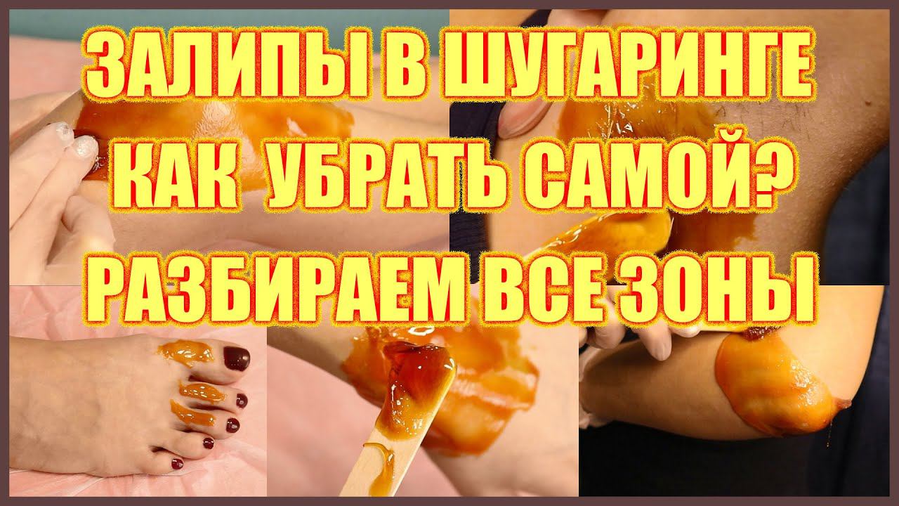 Залипы при шугаринге. Как убрать самостоятельно. Разбираем все зоны. смотреть онлайн